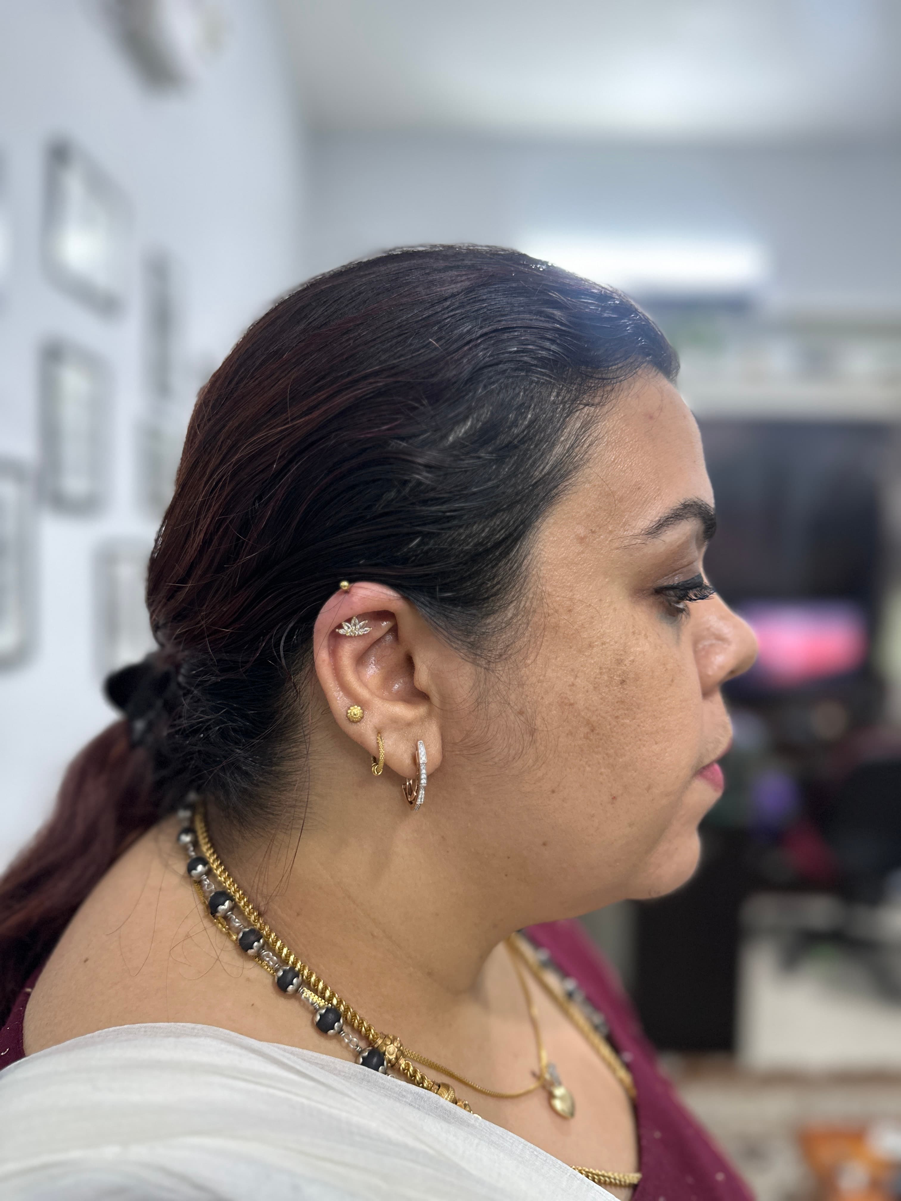 Lobe upgrade